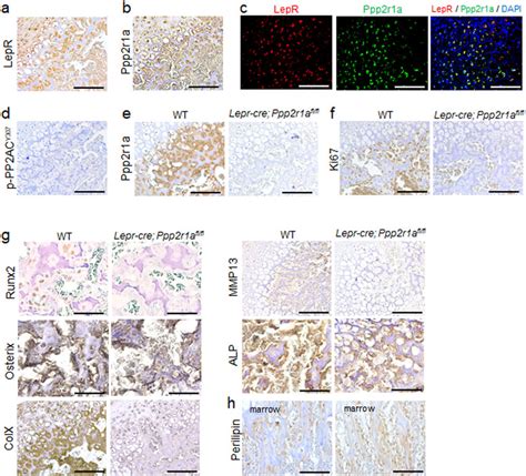 Deletion Of Pp2a In Lepr Mscs Inhibited Proliferation And