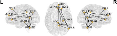 Frontiers Intrinsic Functional Connectivity In The Default Mode