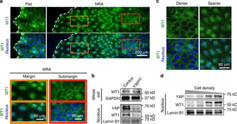 Similar Subcellular Localization Of Wt1 With Yap A Immunofluorescence Download Scientific