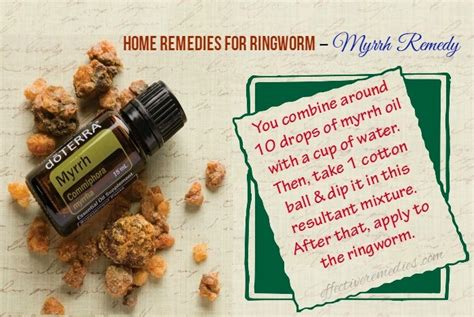 15 Best Natural Home Remedies For Ringworm In Humans