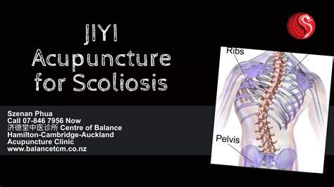 Jiyi Acupuncture For Scoliosis Acupuncture Clinic Hamilton Cambridge