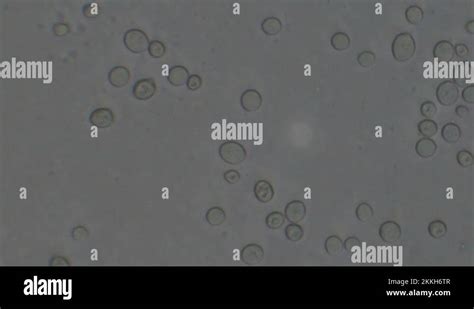 Microscopy Of Yeast Cells Saccharomyces Cerevisiae Monochrome