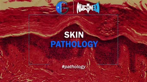 The Skin Pathology Drahmed Youtube