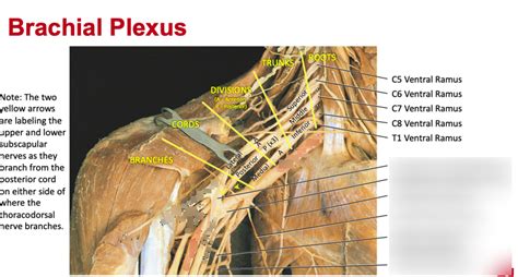 Lab Brachial Plexus Diagram Quizlet