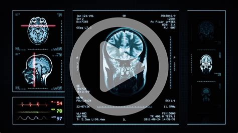 Magnetic Resonance Imaging 1st Discipline Program