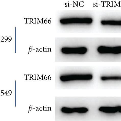 Trim Knockdown Inhibits The Migration And Invasion Of Nsclc Cells And