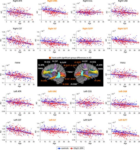 Identifying Neurodevelopmental Anomalies Of White Matter Microstructure