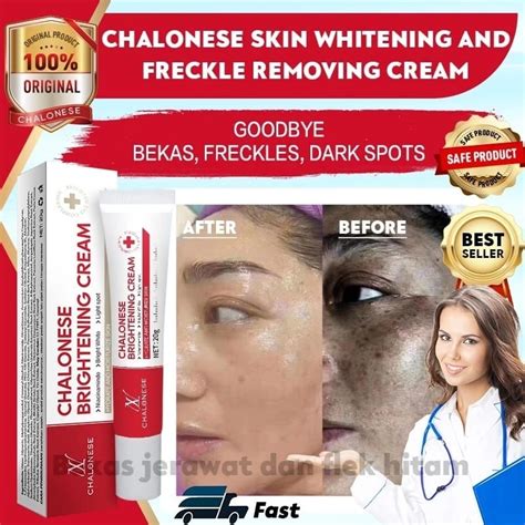 Jual CHALONESE WiTeninG N Glowing Memudarkan Flek MenaHuN Cream