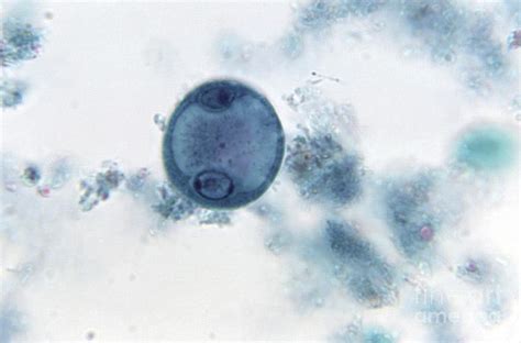 Entamoeba Coli Cysts And Trophozoites