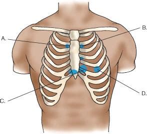 Chapter 30 Assessment Of The Cardiovascular System Flashcards Quizlet