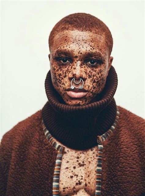 10 Haitian Male Models You Should Keep Your Eye On Beautiful Freckles