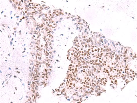 Jund Anti Jund Rabbit Polyclonal Antibody