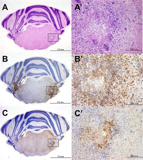 Immunohistochemical Analysis Of Macrophages Microglia And Inos In