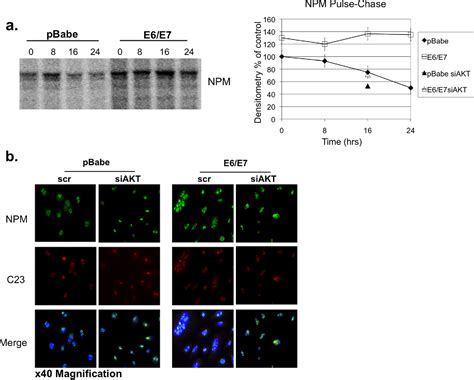 Figure 1 From Human Papillomavirus Type 16 E6 E7 Upregulation Of