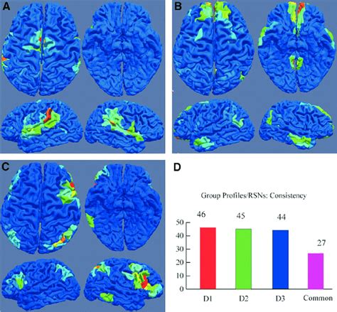 Common Group Resultant Functional Networks Rsns And Their Profiles