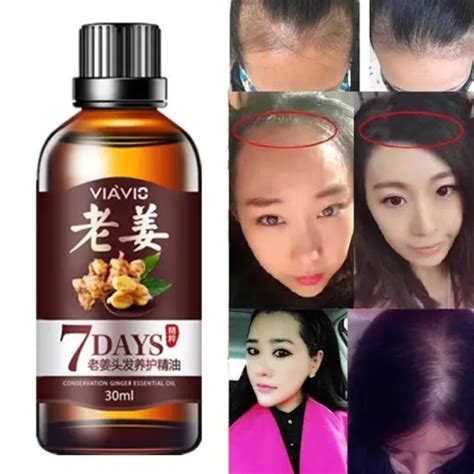 30ml Ginger Hair Oil Hairs Essential Oils Hair Growth Serum Hair