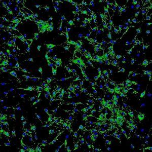 Human Ocular Choroid Fibroblasts Innoprot Primary Ocular Cell System