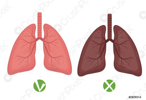 Pulm Es Saud Veis E Doen A Pulmonar Ou Infogr Vetor De A Es Crushpixel