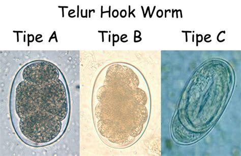 Cacing Tambang Hook Worm Indonesian Medical Laboratory