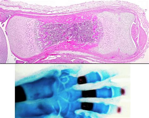 Long Bone Ossification 1 By Jose Calvo Science Photo Library