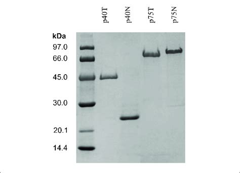 Sds Page Of The Ninta Purified His Tagged Proteins P P T And P