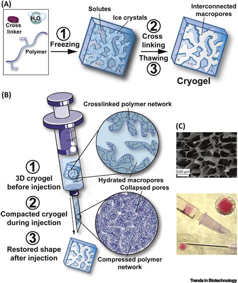 Injectable Cryogels For Biomedical Applications Trends In Biotechnology