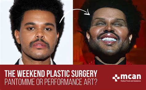 The Weekend Plastic Surgery; True or False?