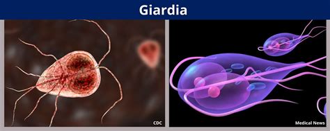 Giardia Benton Franklin Health District