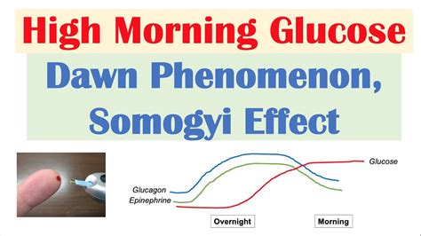 High Early Morning Glucose Dawn Phenomenon Somogyi Effect Youtube