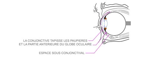 Pathologies Oculaires Lhémorragie Sous Conjonctivale Pôle Vision