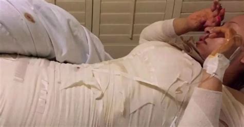 Teen Mum Contracts GANGRENE When Deadly Tummy Tuck And Boob Job Goes Dangerously Wrong In Most