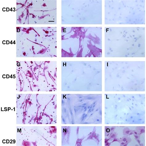 Detection of surface markers on monocytes by flow cytometry. PBMC were ...