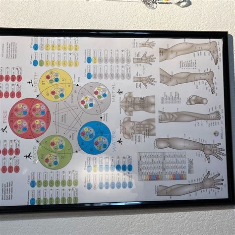 Dermatomes Myotomes And Dtr Poster 20 X 30 Chiropractic Etsy Uk Artofit