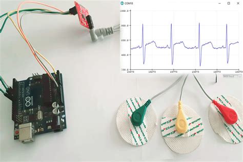 Ad8232 Ecg Sensor Arduino Interfacing With Ecg Graph NBKomputer