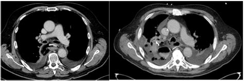 Journal Of Clinical Images And Medical Case Reports