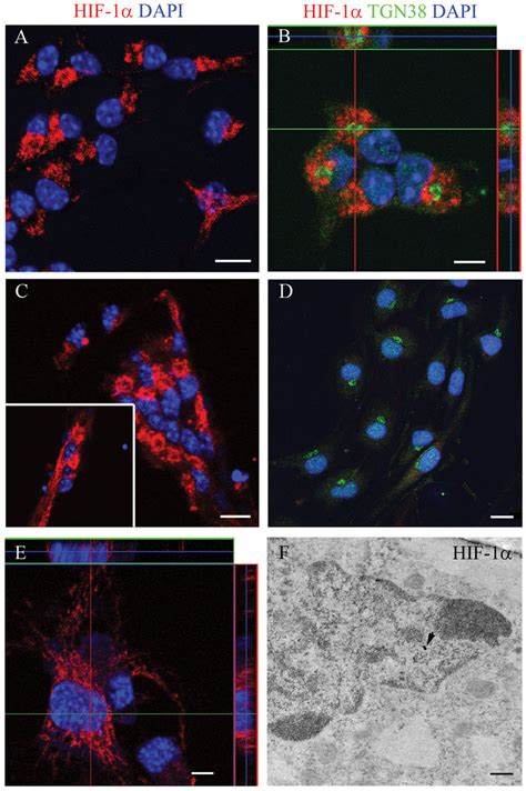 Confocal Microscopy Analyses Of The Subcellular Distribution Of Hif