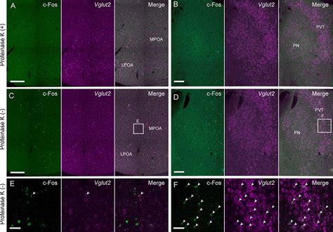 Frontiers Modified In Situ Hybridization Chain Reaction Using Short