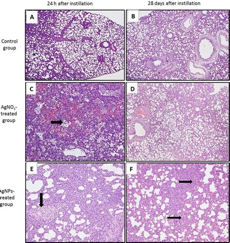 Histopathology Of Lung Tissues H E Staining A And B Show Lung The