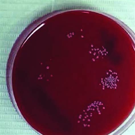 Sheep Blood Agar Plates Showing Bacterial Growth Of Coagulase Negative