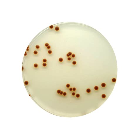 Bismuth Sulfite Glucose Glycine Yeast Biggy Agar 90mm Plate Sgl