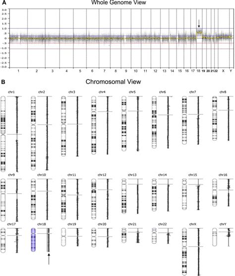 A Whole Genome View And B Chromosomal View Of Array Comparative