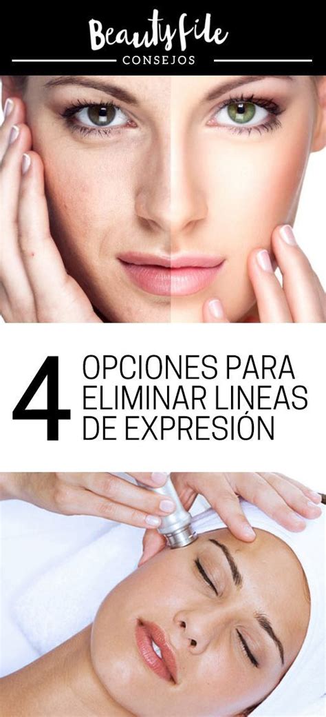 C Mo Eliminar Las L Neas De Expresi N De La Boca Como Eliminar Los