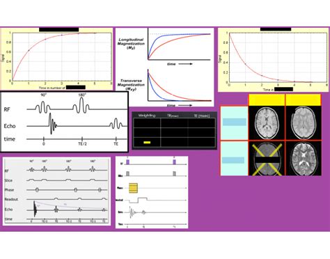 mri graphs quiz