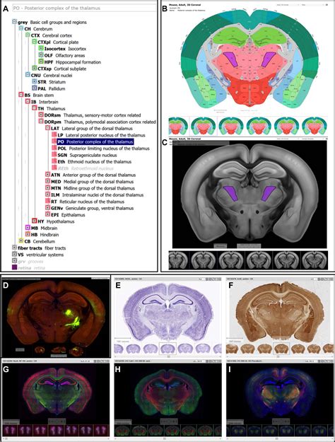 The Allen Mouse Brain Common Coordinate Framework A 3d Reference Atlas