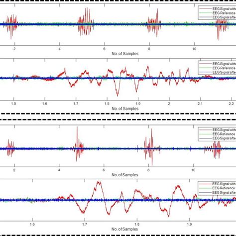 Motion Artifact Correction From Example FNIRS Signals Using WPD Sym5