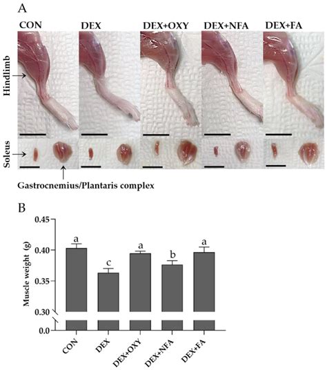 Gastrocnemius Muscle Mouse