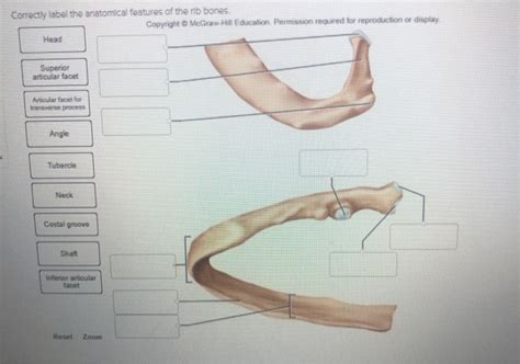 Solved Correctly Label The Anatomical Features Of The Rib