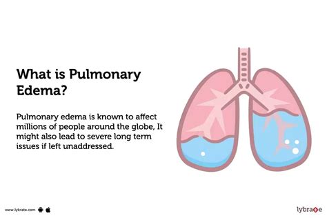Pulmonary Edema Symptom Causes Treatment And Prevention