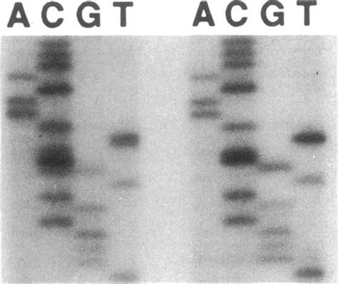 Identification of fibrillin gene mutation C1409S in a proband of a ...