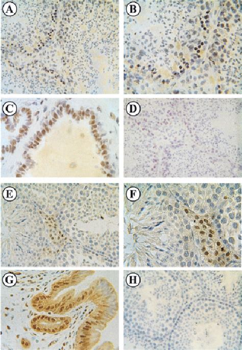 Immunohistochemical Localization Of Oestrogen Receptor β Er β And Er